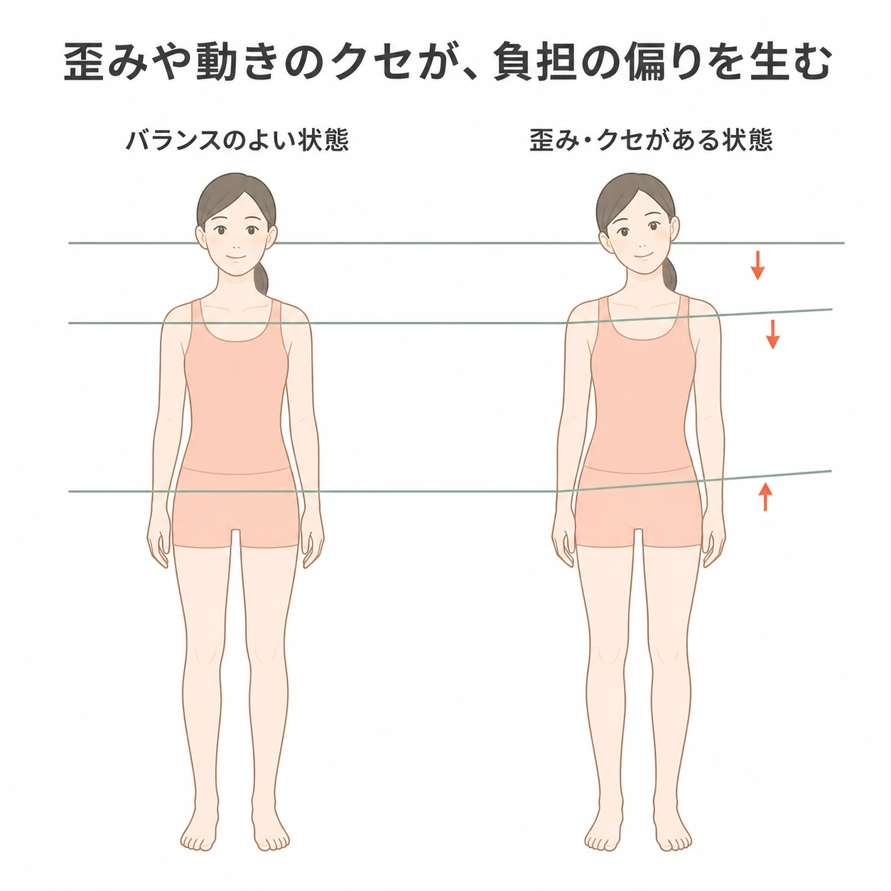 身体のバランスがよい状態と歪みやクセがある状態を比較し、負担の偏りを示す図解